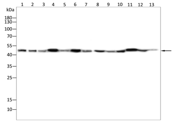 ORM1 Antibody