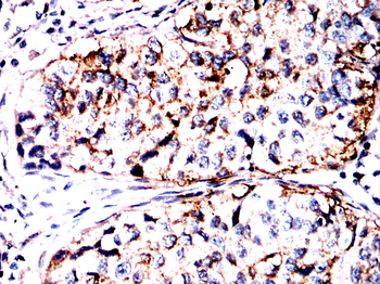 IGF2BP3 Antibody