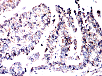 IGF2BP3 Antibody