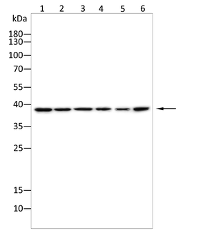 NDEL1 Antibody