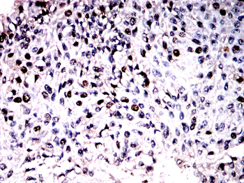 NR3C1 Antibody