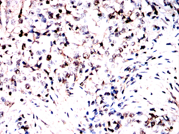 NR3C1 Antibody