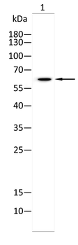 YTHDF2 Antibody