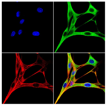 ASL Antibody