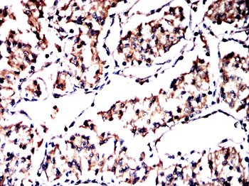 HSPA9 Antibody