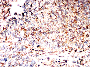 DLAT Antibody