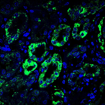 DLAT Antibody