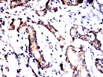 DLAT Antibody