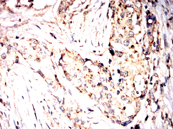 DLAT Antibody