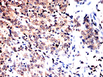 PRDM16 Antibody