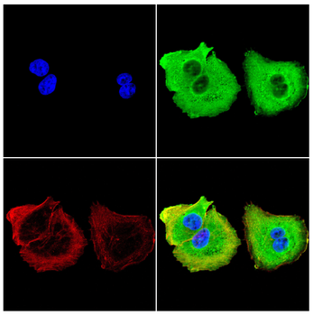 IGLC2 Rabbit Polyclonal Antibody