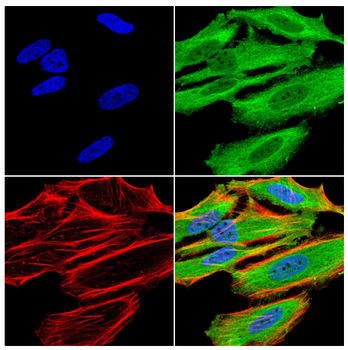 IGLC2 Rabbit Polyclonal Antibody