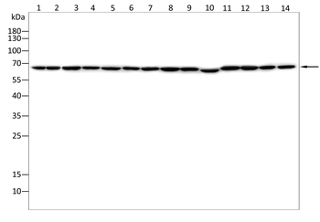UGP2 Antibody