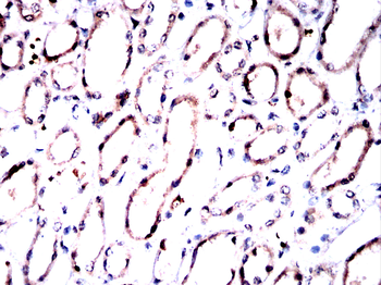 CELF1 Antibody