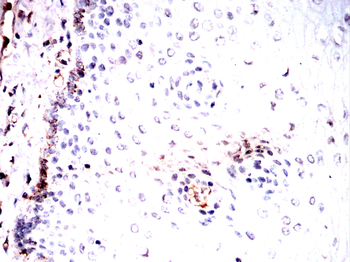 RAB5A Antibody