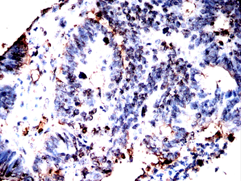 KHSRP Antibody