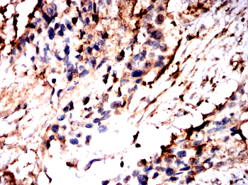 KHSRP Antibody