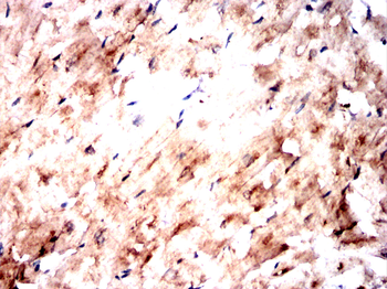 KHSRP Antibody