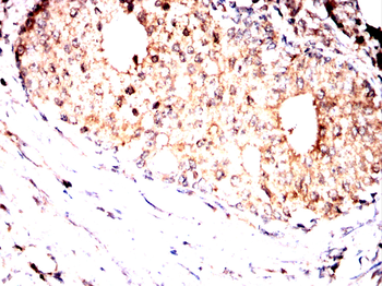 RALB Antibody