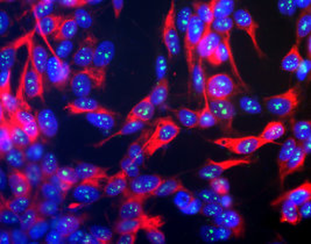 Fibrillarin/Nop1p- Nucleolar Marker Antibody
