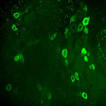 Endomorphin 1 Antibody