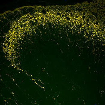 Endomorphin 1 and 2 Antibody