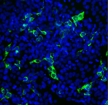 SARS-CoV2 S-Protein ACE2 Binding Domain Antibody