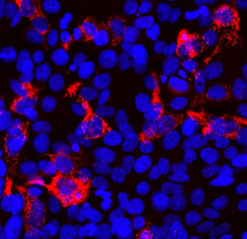 SARS-CoV2 S-Protein ACE2 Binding Domain Antibody