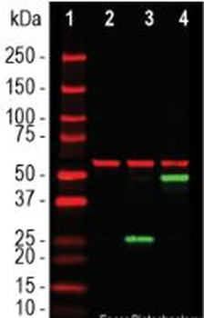 SARS-CoV2 S-Protein ACE2 Binding Domain Antibody
