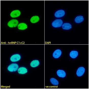 Recombinant hnRNP C1+C2 Monoclonal Antibody