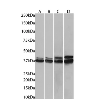 Recombinant hnRNP C1+C2 Monoclonal Antibody