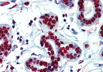 Recombinant hnRNP C1+C2 Monoclonal Antibody