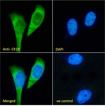Cytokeratin 18 Monoclonal Antibody
