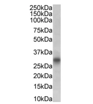 CD8 Mouse Monoclonal Antibody