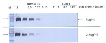 GBV-C virus glycoprotein E2 Monoclonal Antibody