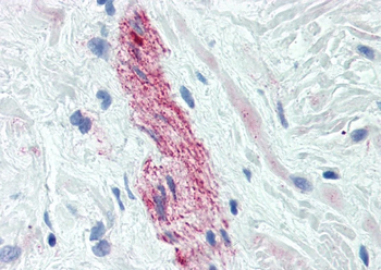 Nestin (Neural Stem Cell Marker) Mouse Monoclonal Antibody (FITC)