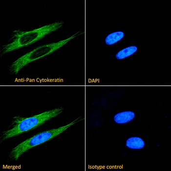 Human Cytokeratin 18 Antibody