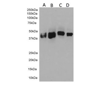 Human Cytokeratin 18 Antibody
