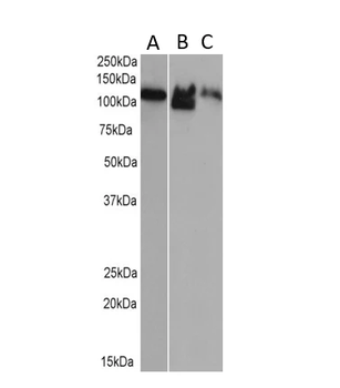 Major Vault Protein [1032], Rabbit IgG, Kappa Recombinant Monoclonal Antibody