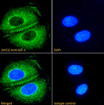Insulin-Like Growth Factor Antibody
