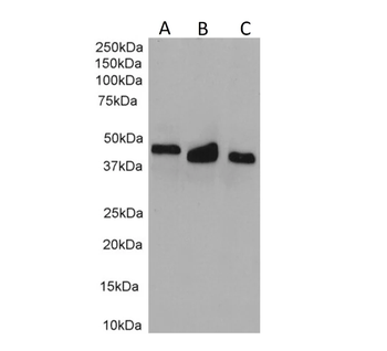 Human Cytokeratin 18 Antibody