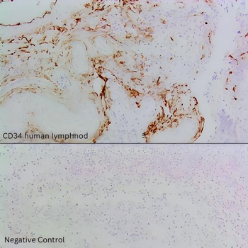 CD34 Antibody
