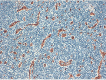 CD34 Monoclonal Antibody