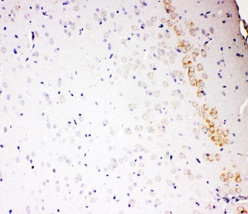 ALDH2 Rabbit Polyclonal Antibody