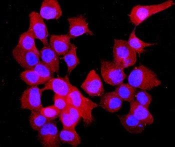 Annexin VII/ANXA7 Rabbit Polyclonal Antibody