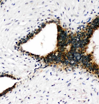 Annexin VII/ANXA7 Rabbit Polyclonal Antibody