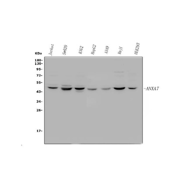 Annexin VII/ANXA7 Rabbit Polyclonal Antibody