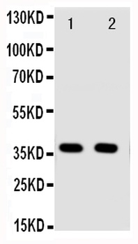 Annexin A10/ANXA10 Rabbit Polyclonal Antibody