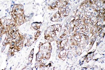 VE-Cadherin CDH5-/VE Rabbit Polyclonal Antibody