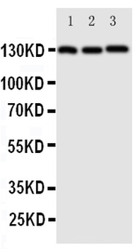VE-Cadherin CDH5-/VE Rabbit Polyclonal Antibody